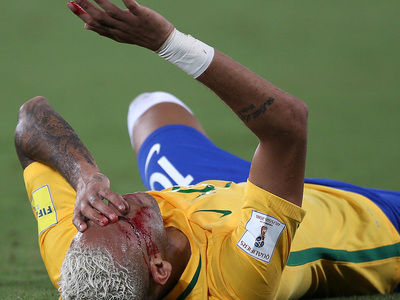 Неймару разбили лицо в победной для Бразилии игре с Боливией