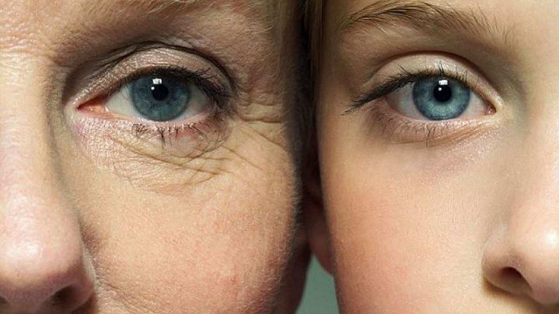 морщины под глазами в 40 лет фото