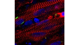 Сечение мышечных волокон. Красные клетки √ это мышечные клетки, зелёные области √ рецепторы входного сигнала нейрона, а синие пятна √ это ядра клеток. 