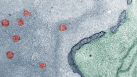 Полимеросомы (показаны красным) должны попасть в ядро через разрывы в его мембране (тёмно-синяя).