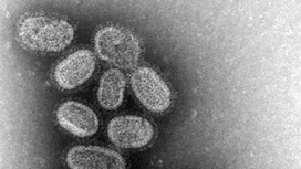 Вирус гриппа под электронным микроскопом 
