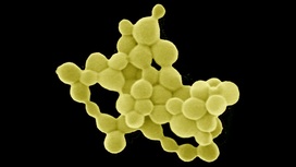 Странная бактерия "переваривает" токсичные металлы в золотые "самородки"