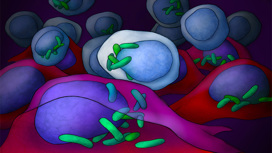 Специфичные бактерии обнаружены в клетках почти всех раковых опухолей