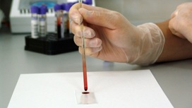 Новый анализ крови может выявить рак гораздо раньше традиционных методов.