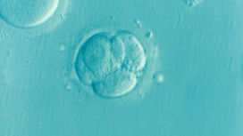 Примерно через три недели после оплодотворения у эмбриона формируется нервная трубка - предшественник мозга.