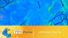 В России разрабатывают новые методики использования стволовых клеток