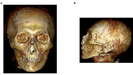 Трёхмерное изображение компьютерной томографии лица мумии Аменхотепа I.