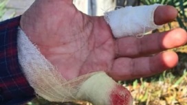Двое мужчин напали на охранника и отрезали ему палец