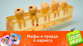 Что такое кариес и как он возникает