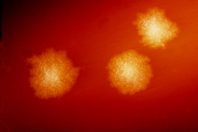 Клостридии вида Clostridium difficile могут вызывает жуткие заболевание, не поддающиеся лечению антибиотиками