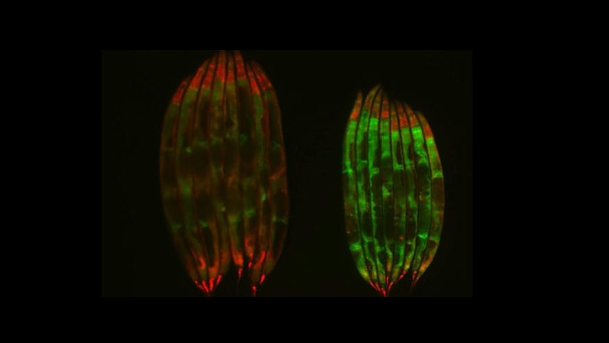 Старые аскариды вида Caenorhabditis elegans. Черви с ограничениями в диете (справа) демонстрируют лучший уровень сплайсинга по сравнению с естественно стареющими организмами (слева).
