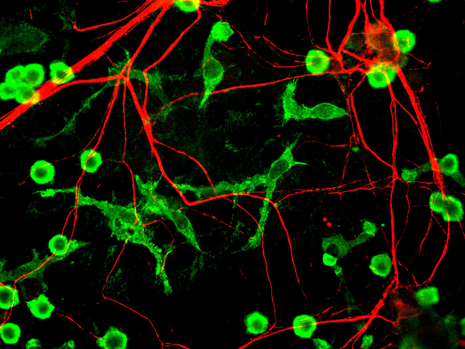 Микроглия в культуре клеток мозга крыс обозначена зелёным, волокна нервной ткани — красным.