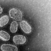 Вирус гриппа под электронным микроскопом 