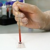 Новый анализ крови может выявить рак гораздо раньше традиционных методов.