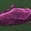 Так выглядит супербактерия Pseudomonas aeruginosa, уничтоженная при помощи антибиотика колистин.
