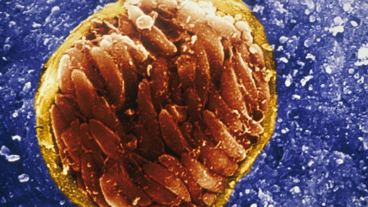 Микрофотография паразита Toxoplasma gondii в кисте в мозге заражённой мыши