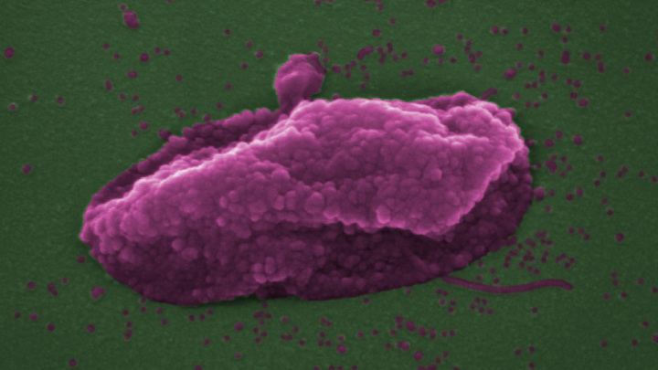 Так выглядит супербактерия Pseudomonas aeruginosa, уничтоженная при помощи антибиотика колистин.