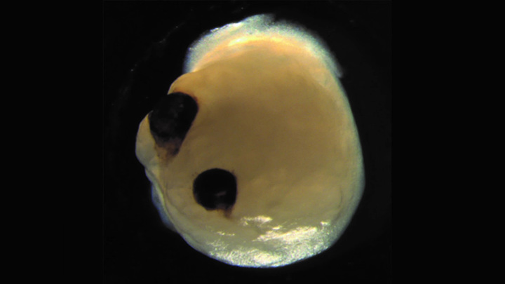 Около 72 процентов органоидов мозга образовали зрительные пузырьки – выступающие из переднего мозга эмбриона мешочки, из которых впоследствии развиваются глаза.