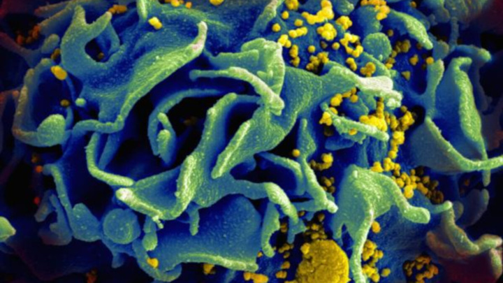 Микроскопическое изображение ВИЧ-инфицированного Т-лимфоцита.